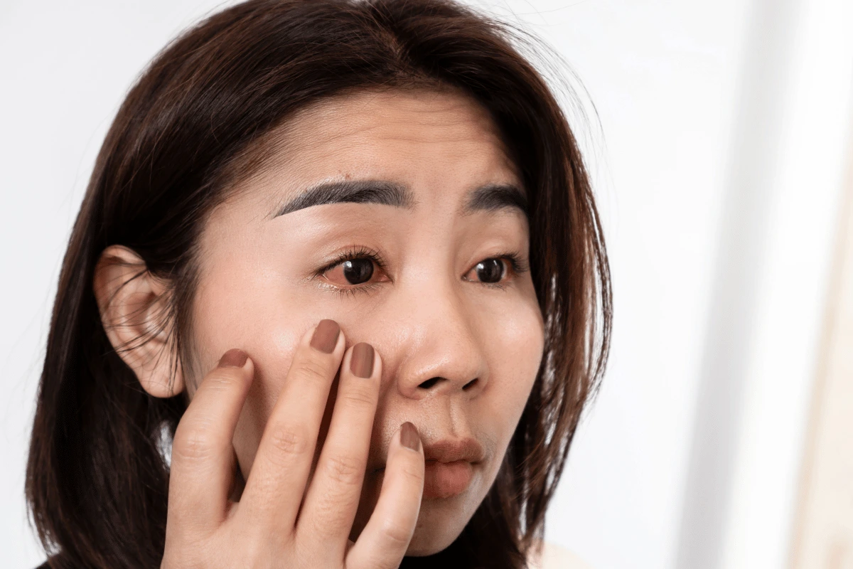 close-up of a woman who needs red eye treatment